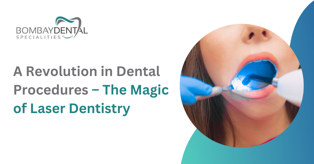 A Revolution in Dental Procedures – The Magic of Laser Dentistry