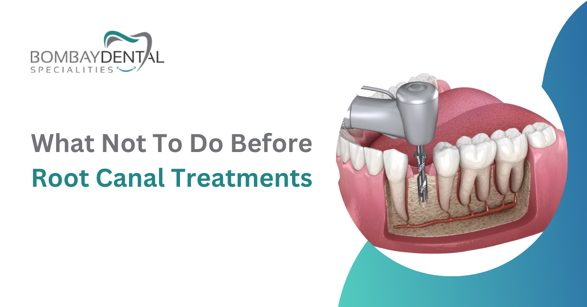 What Not To Do Before Root Canal Treatments