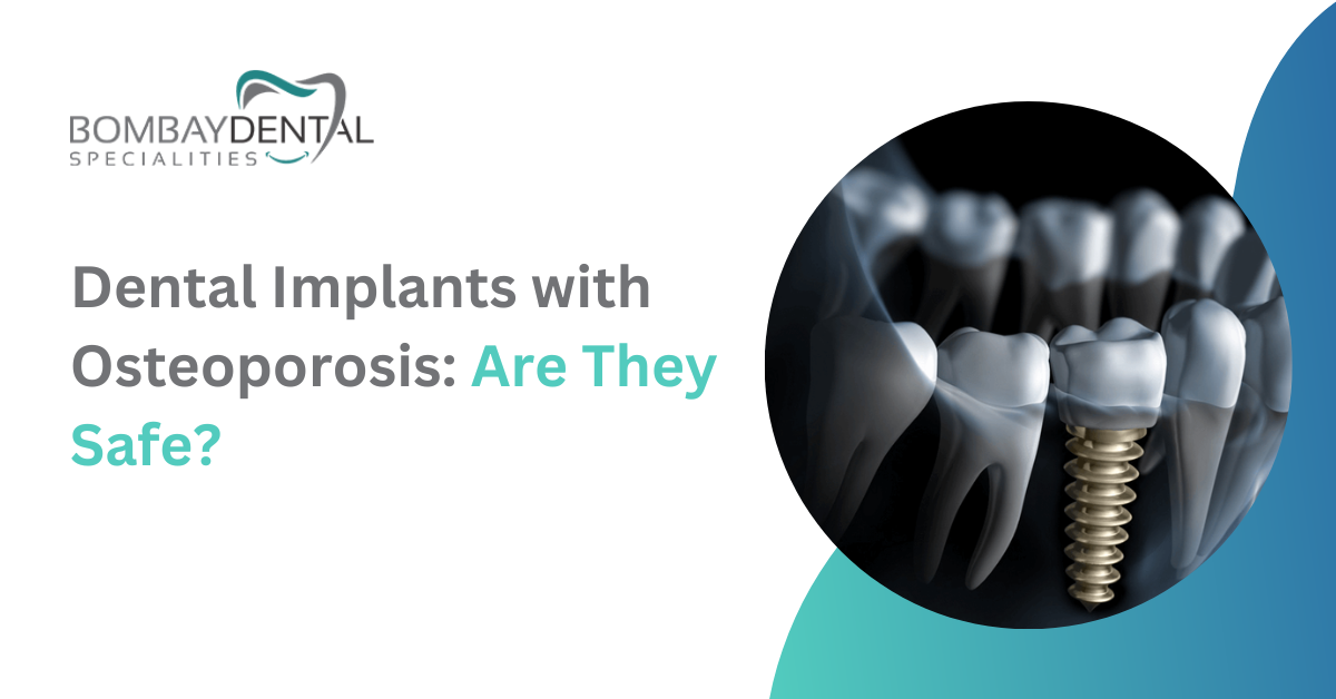 Dental Implants with Osteoporosis: Are They Safe?