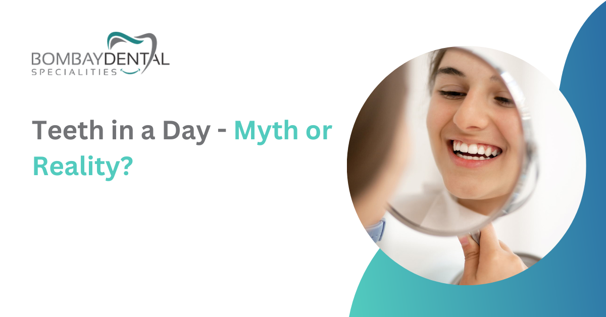 Teeth in a Day—Myth or Reality?